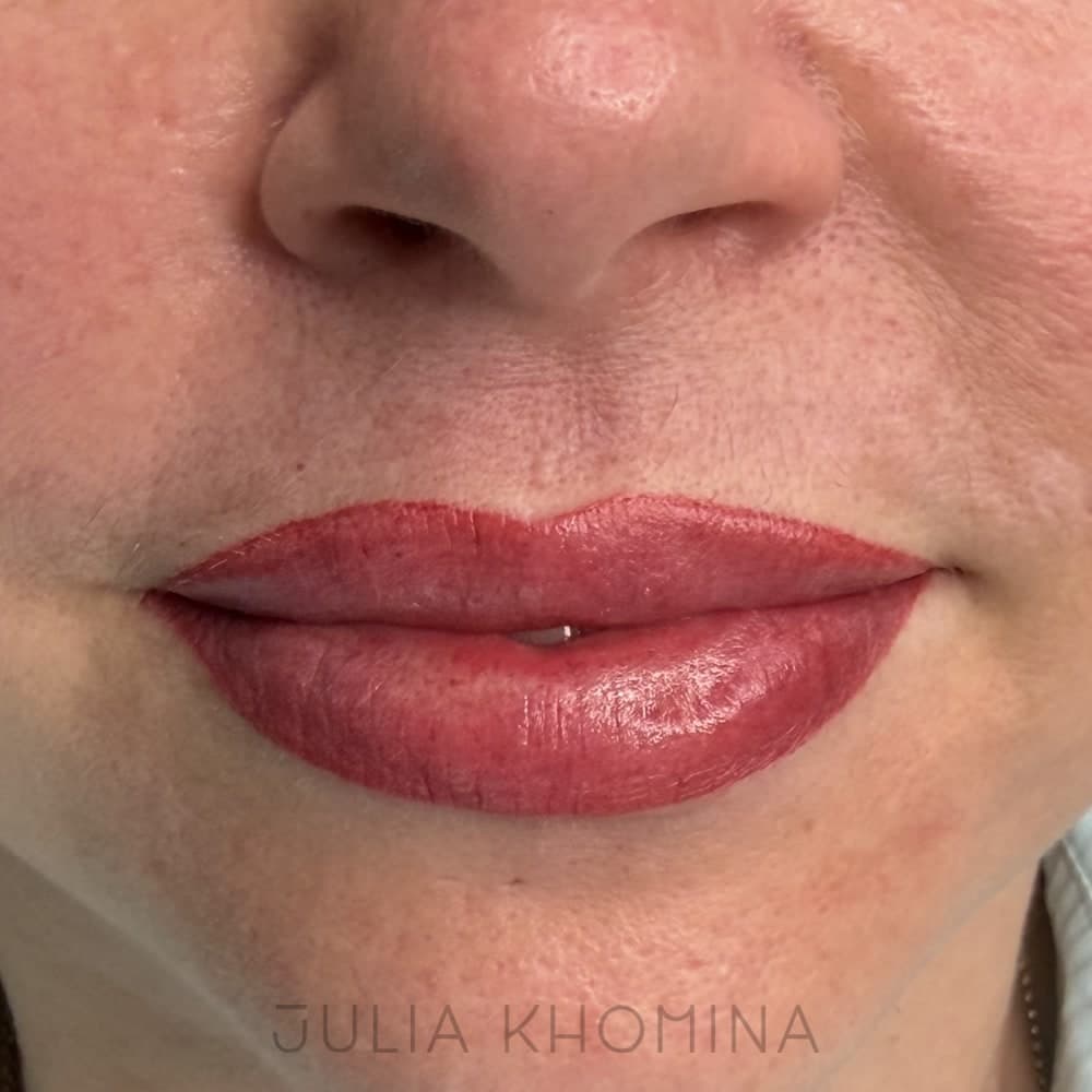 Maquillage permanent des lèvres — après