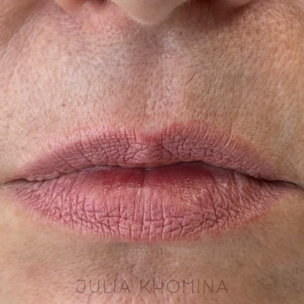 Maquillage permanent des lèvres — avant