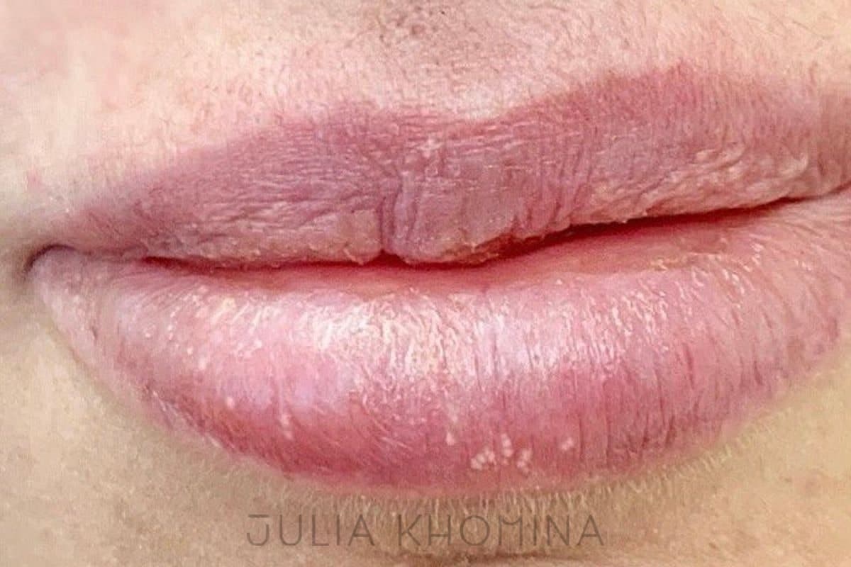 Maquillage permanent des lèvres — avant