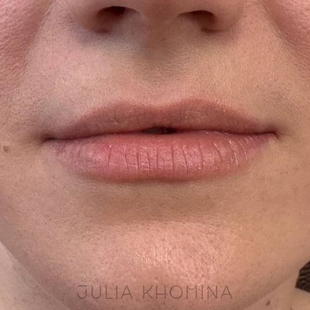 Maquillage permanent des lèvres — avant