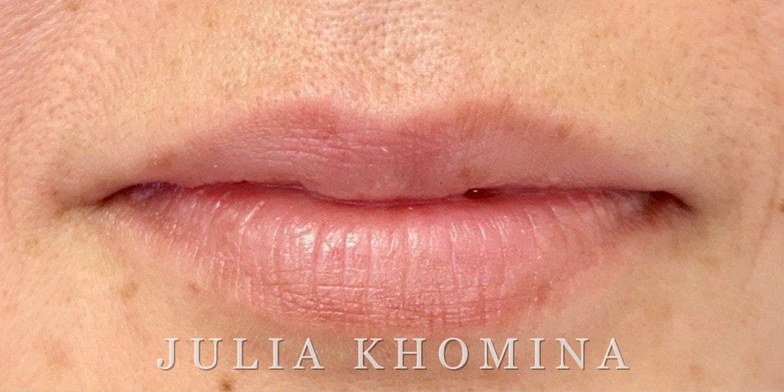 Maquillage permanent des lèvres — avant