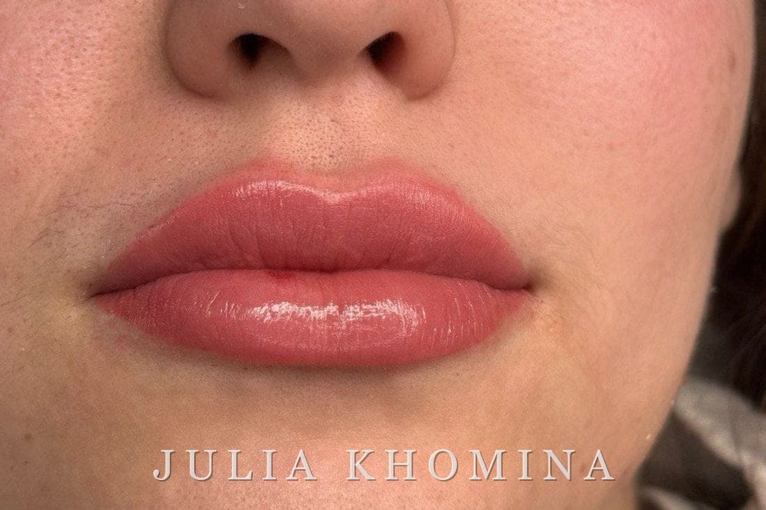 Maquillage permanent des lèvres — après