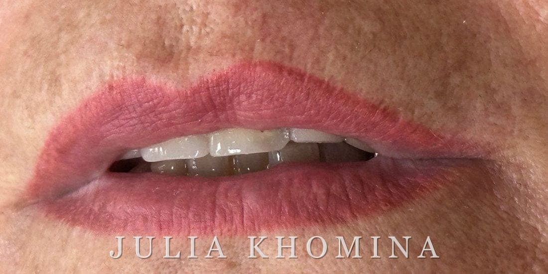 Maquillage permanent des lèvres — après