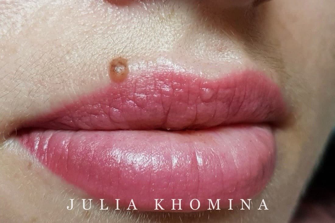 Maquillage permanent des lèvres — après