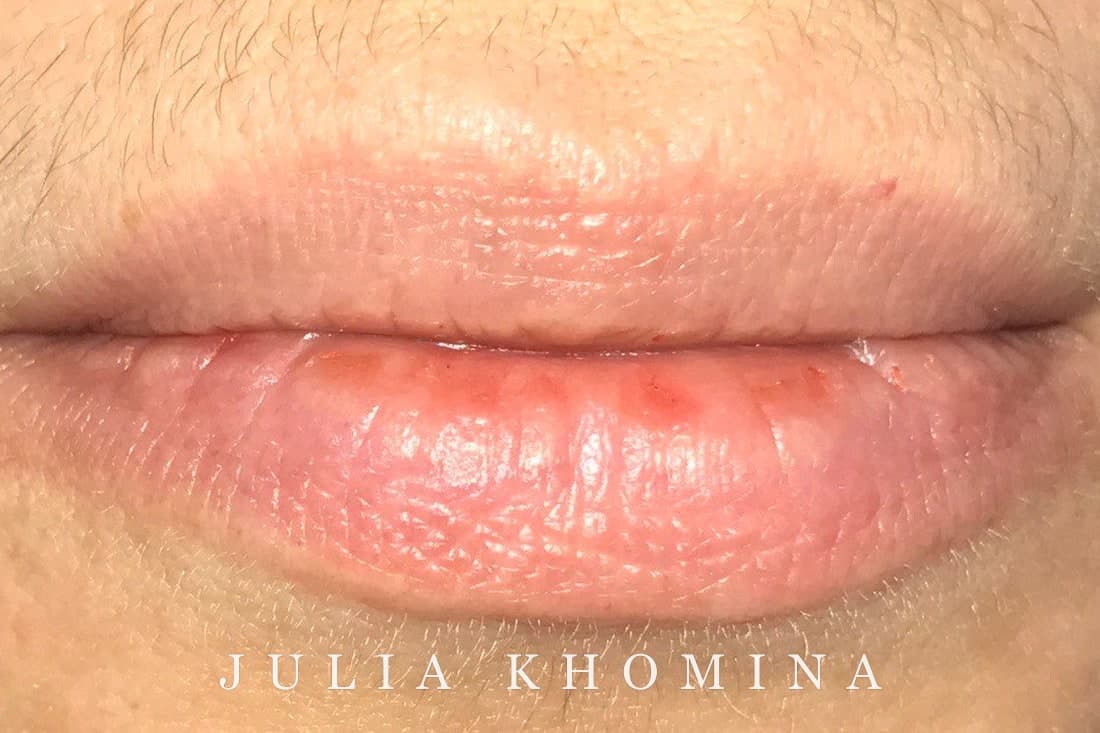 Maquillage permanent des lèvres — avant