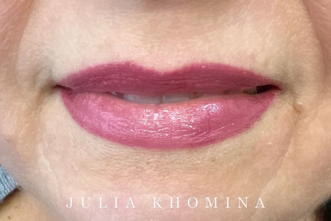 Maquillage permanent des lèvres — après