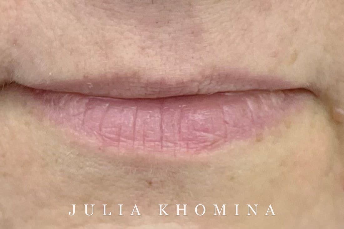 Maquillage permanent des lèvres — avant