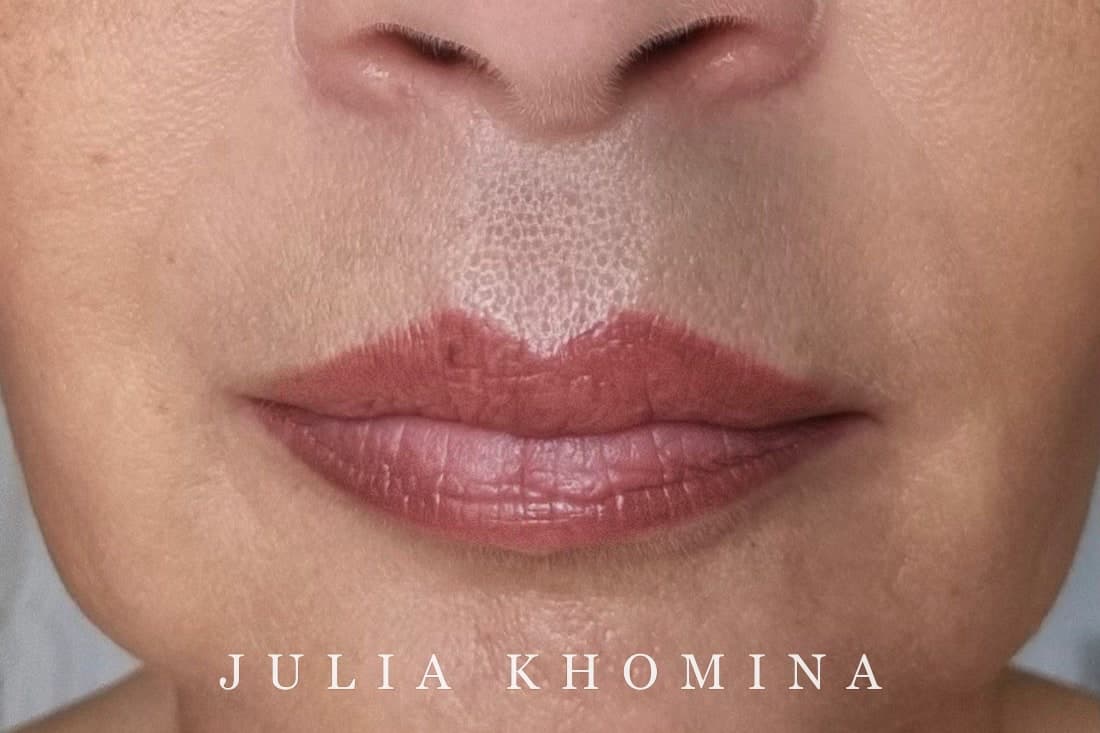 Maquillage permanent des lèvres — après