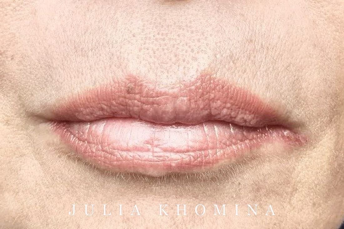 Maquillage permanent des lèvres — avant