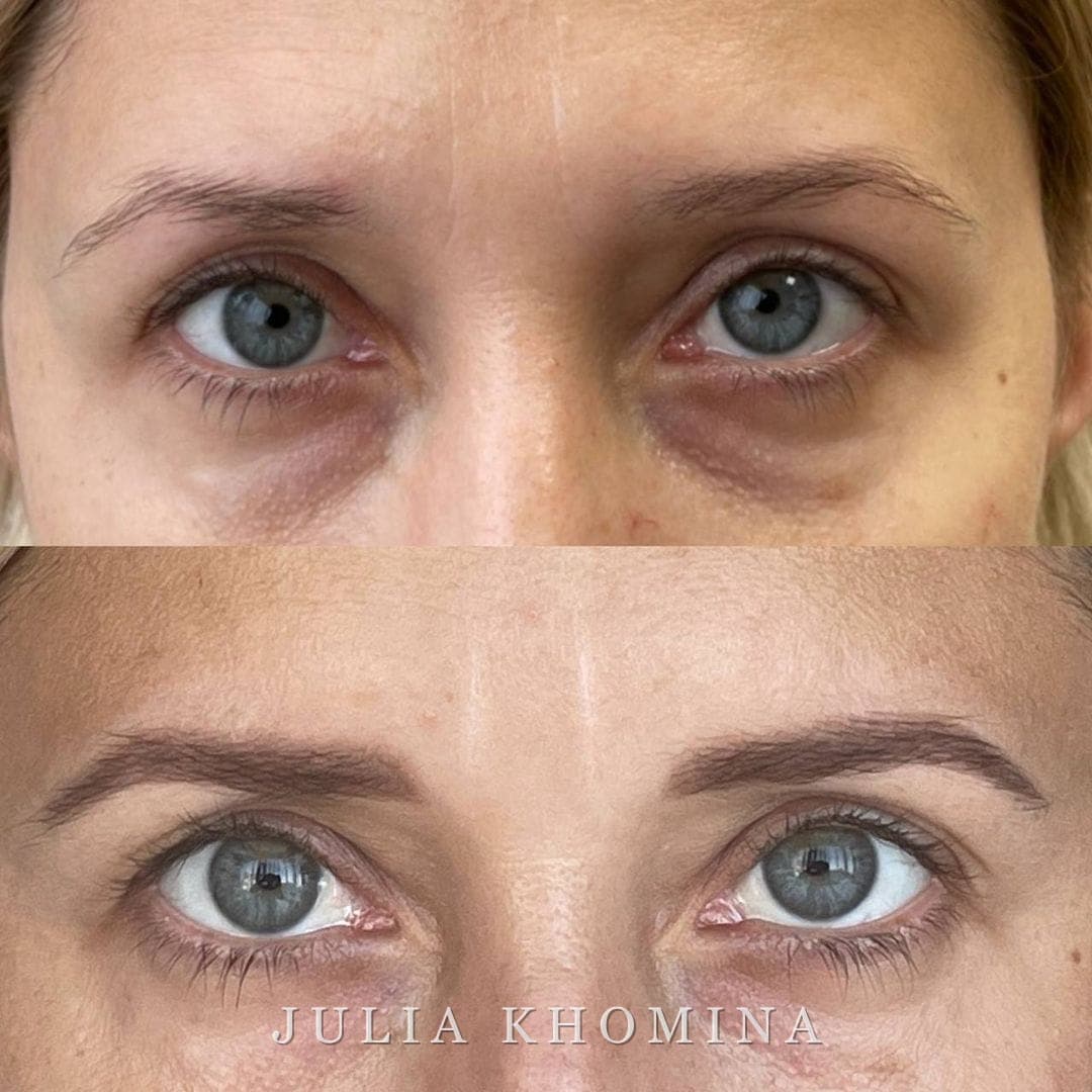Maquillage permanent des sourcils — avant / après