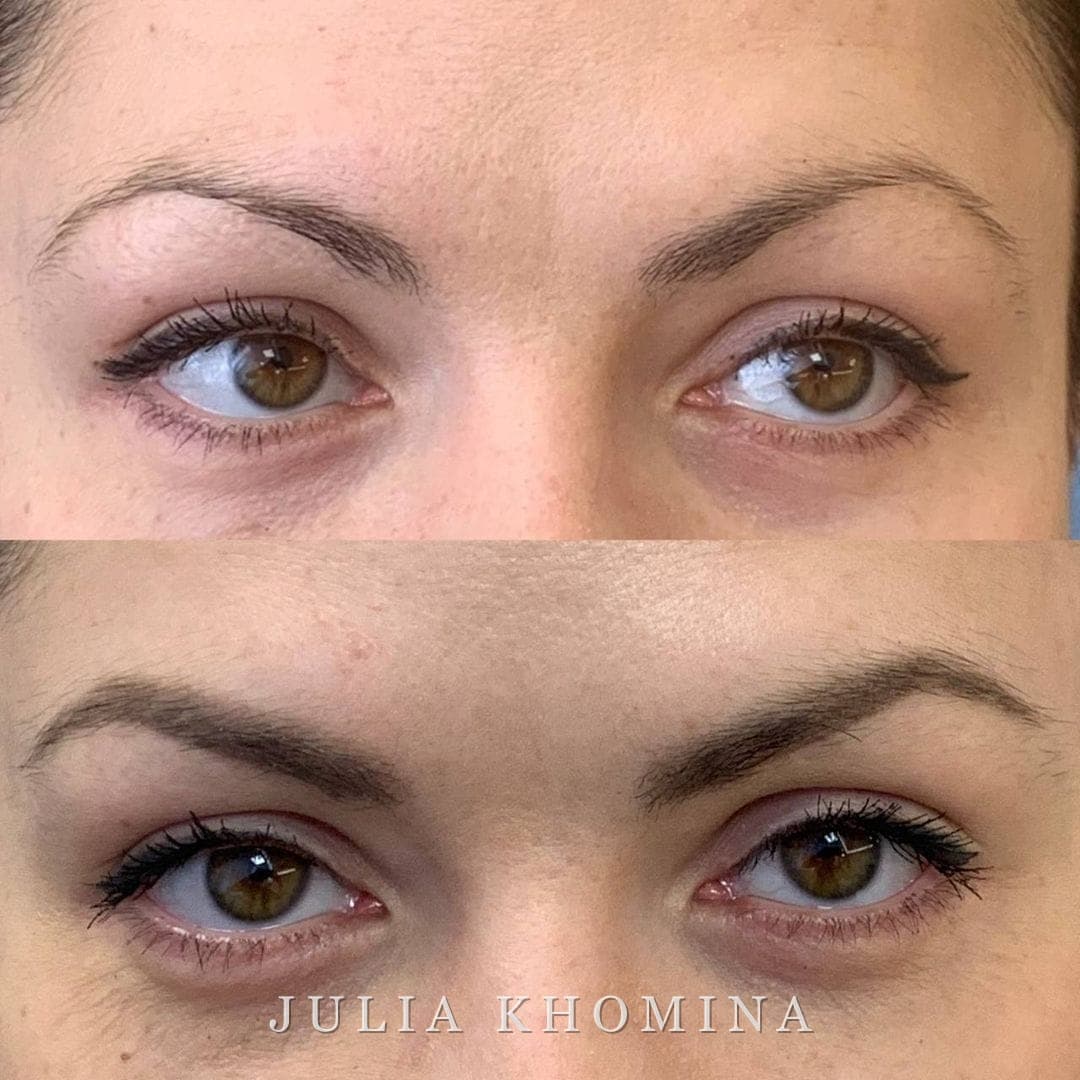 Maquillage permanent des sourcils — avant / après
