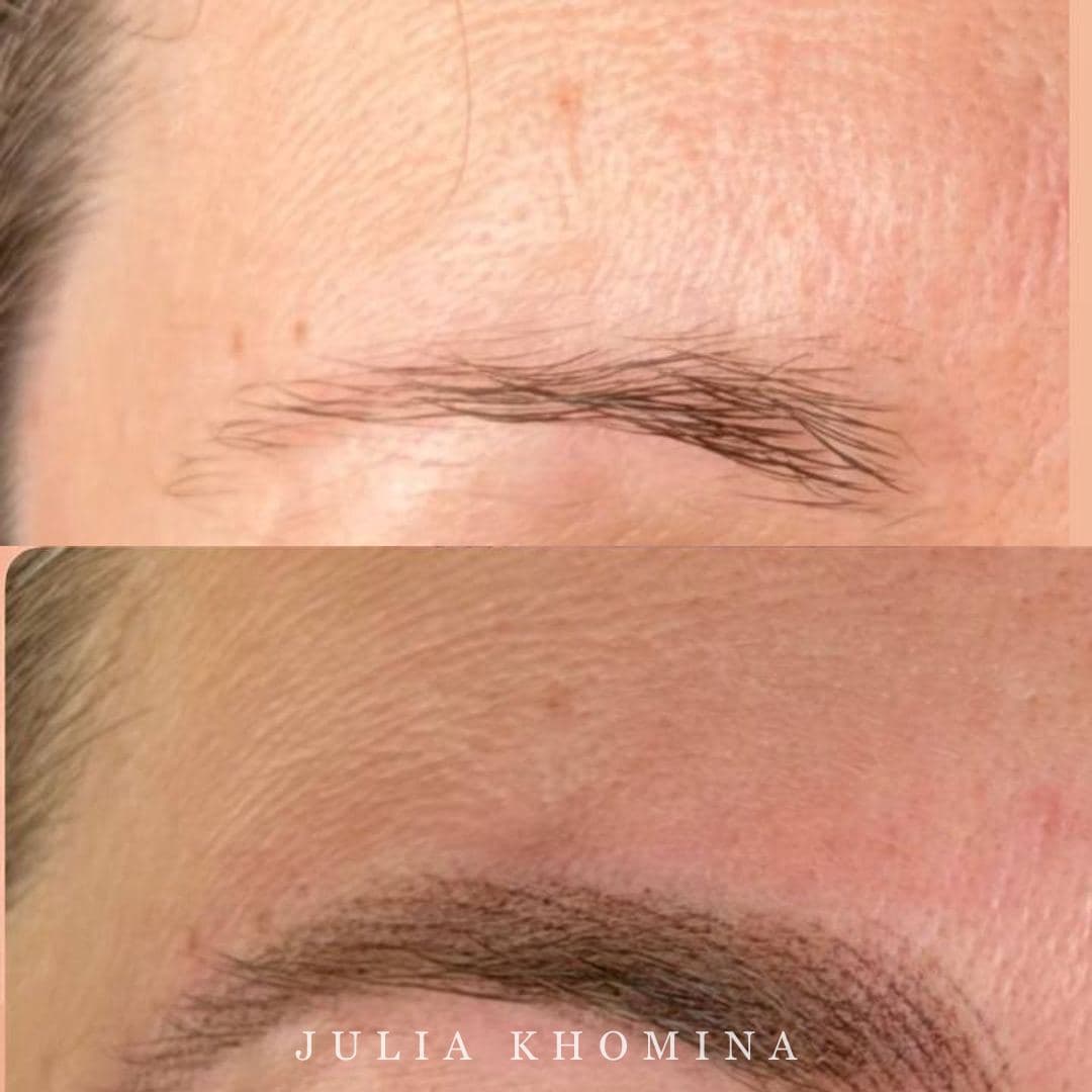 Sourcils Nano Hair Strokes sur sourcils clairsemés — avant / après