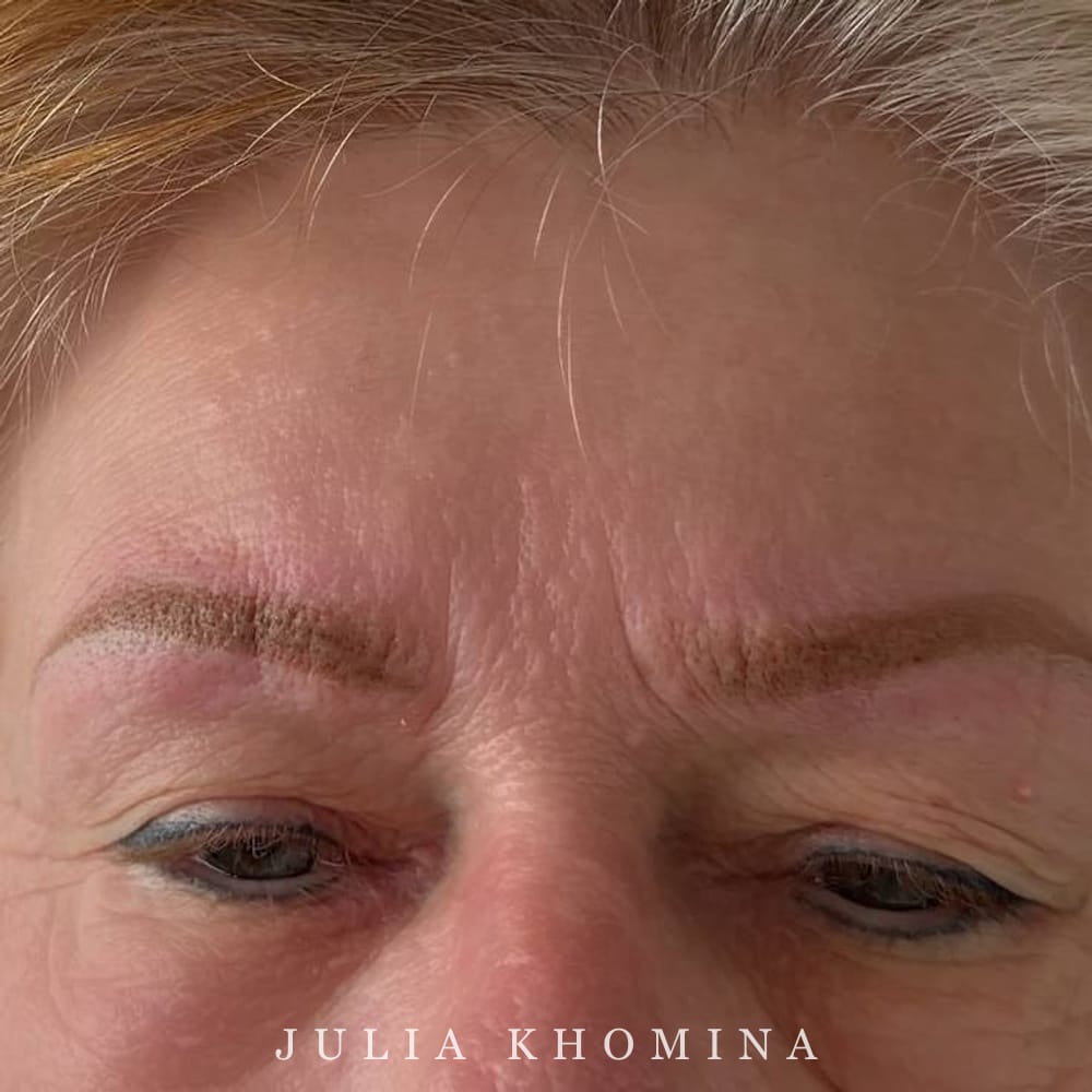 Nouveau maquillage permanent réalisé après détatouage